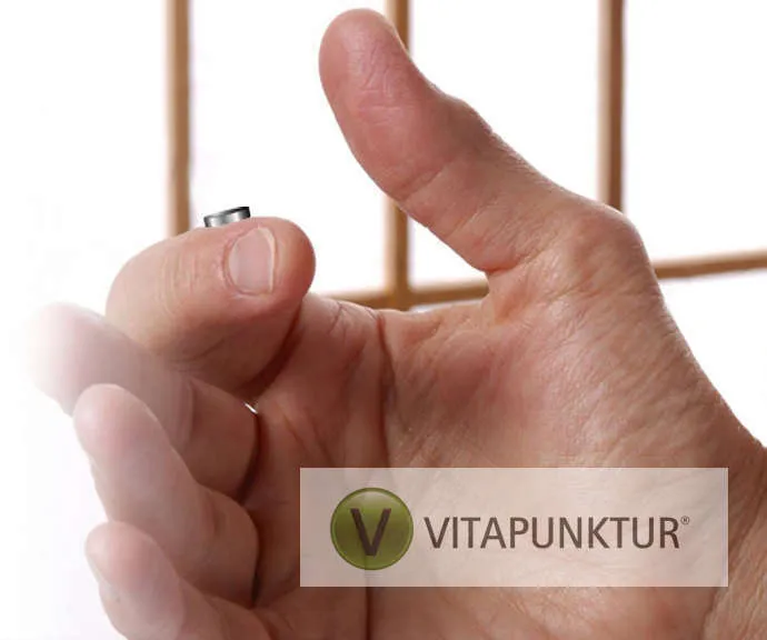 Vitapunktur® – Anwendung mit kleinen Magneten (Herstellerbild)
